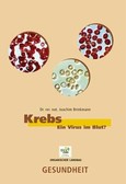 Krebs - Ein Virus im Blut