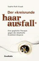 Der kreisrunde Haarausfall